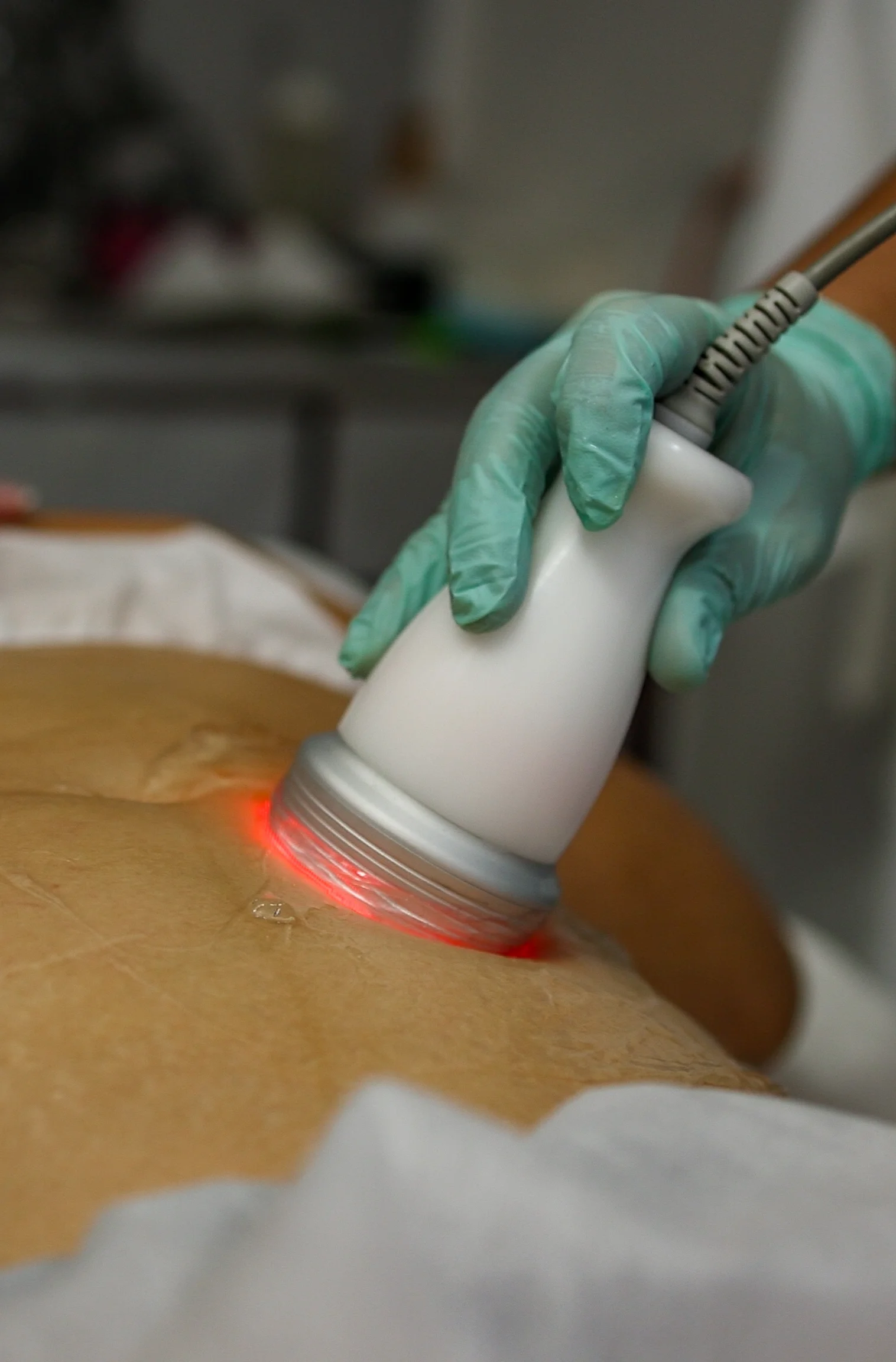Procedimiento de dermatología clínica avanzada en Ambrosía