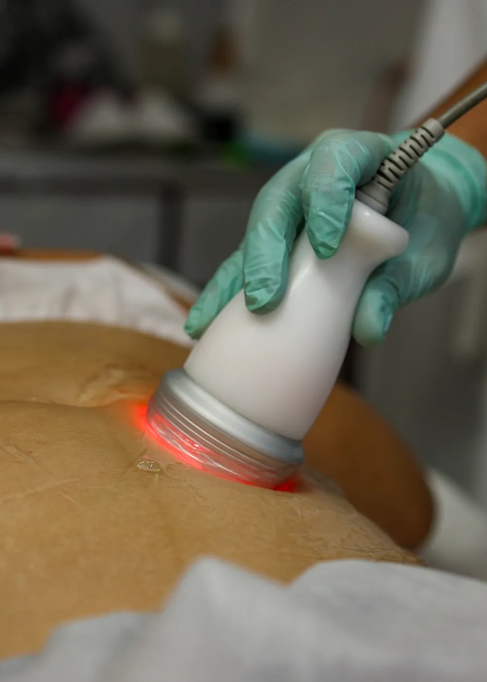 Procedimiento de dermatología clínica avanzada en Ambrosía