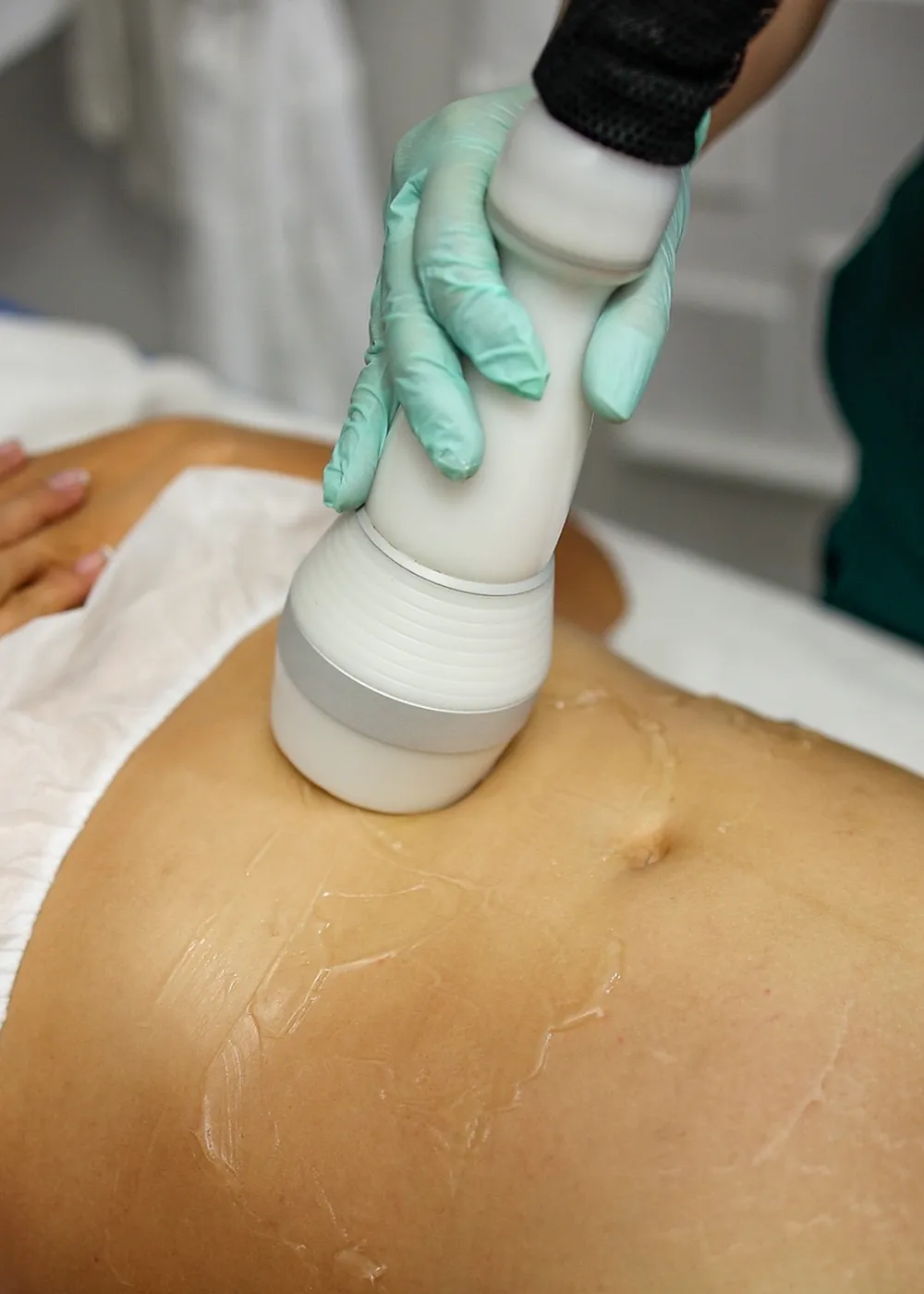 Sesión de aparatología estética de alta precisión sobre la zona abdominal para la eliminación de depósitos adiposos.